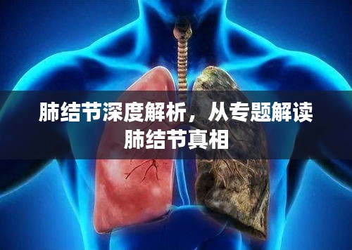 肺结节深度解析，从专题解读肺结节真相