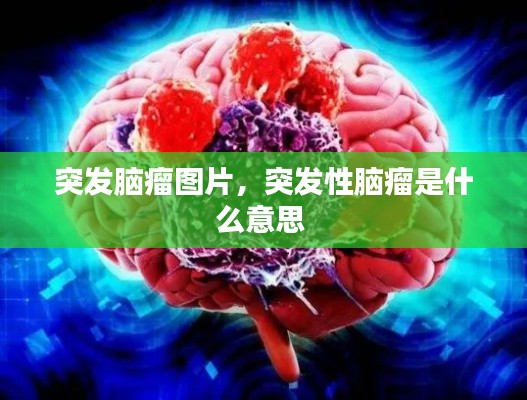 突发脑瘤图片，突发性脑瘤是什么意思 