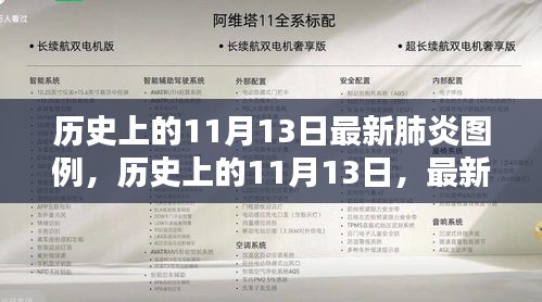 历史上的11月13日，最新肺炎图例深度解析与回顾