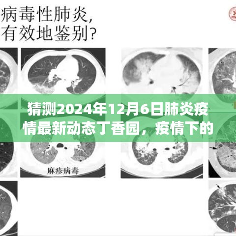 预测未来暖心日常，丁香园展望2024年肺炎疫情最新动态与温馨故事