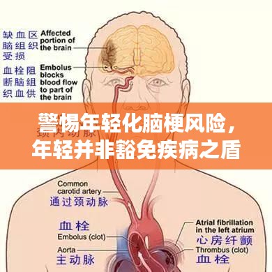 警惕年轻化脑梗风险，年轻并非豁免疾病之盾