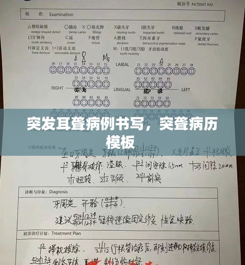 突发耳聋病例书写，突聋病历模板 