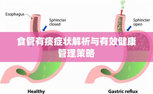 食管有痰症状解析与有效健康管理策略